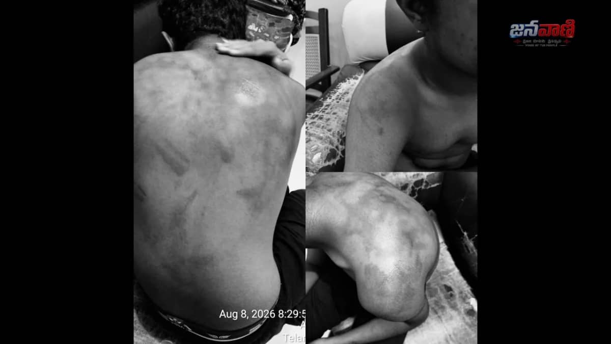 శ్రీచైతన్య హాస్టల్‌లో పదో తరగతి విద్యార్థిపై మూకుమ్మడి దాడి.. పరిస్థితి విషమం